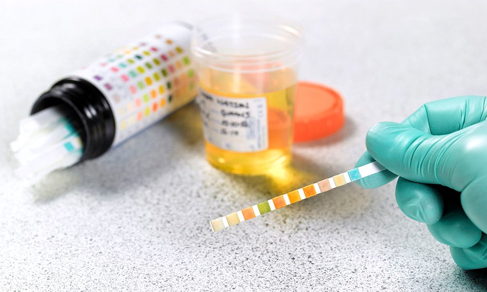 How to Pass A Drug Test: Employers Are Still Testing People For Marijuana - MEDCAN24