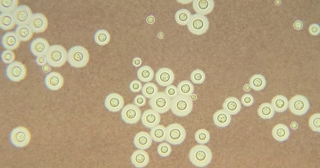 Fungal Infection Linked To Medical Cannabis Flower