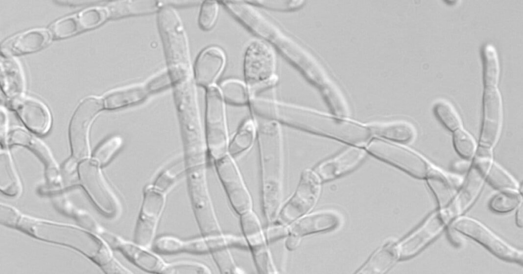 Cannabinoids Produced From Yeast
